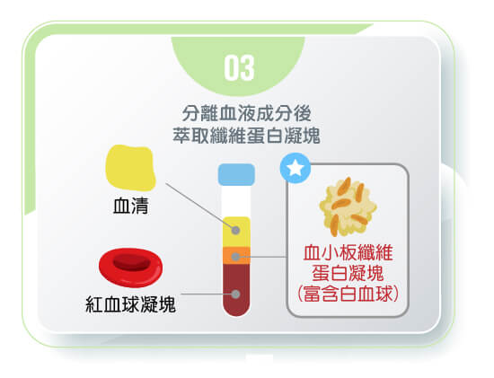 舒適美牙醫聯盟_PRF的製作流程3