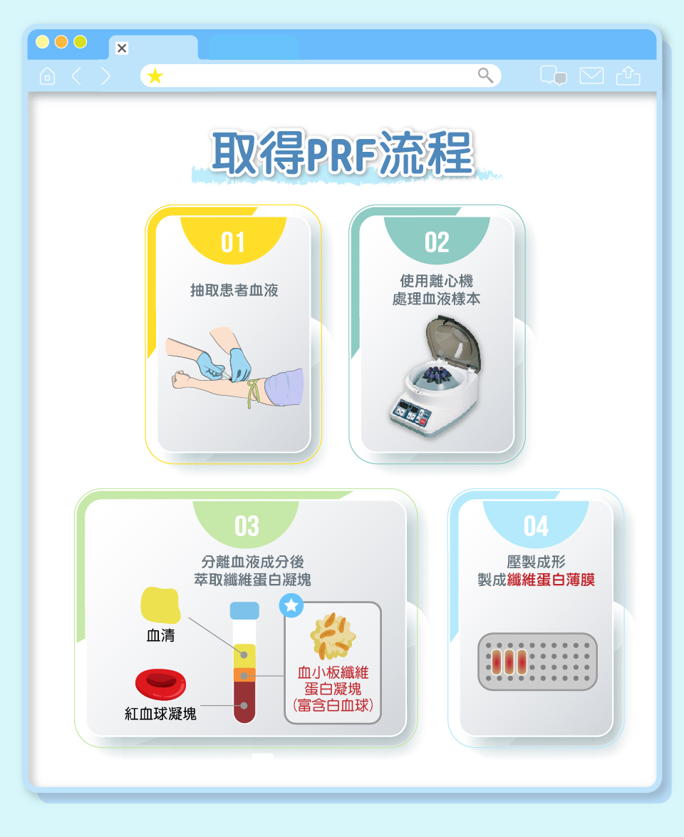 舒適美牙醫聯盟_PRF的製作流程